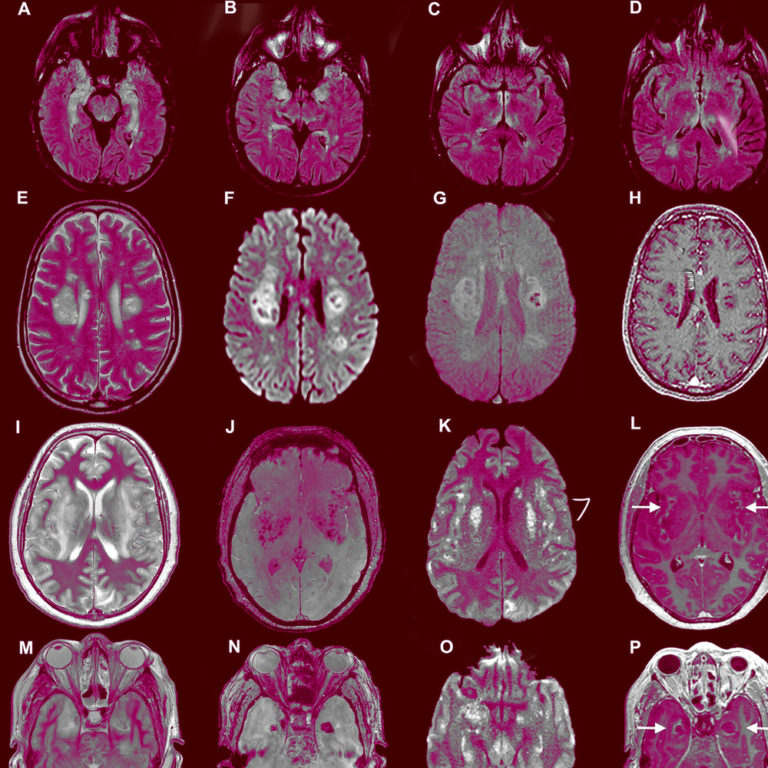 earth2zoe moves on from a breakup with “Amnesia”