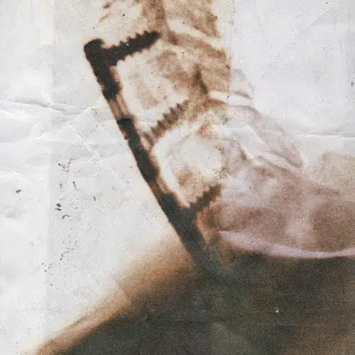 EVNTYD gets even with new single, “Spleen”